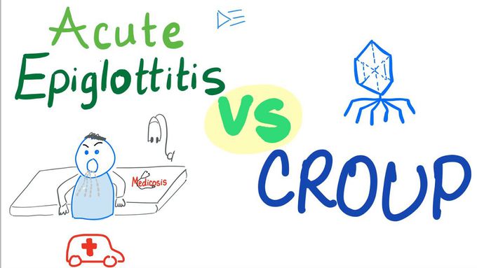 Acute Epiglottitis Vs Croup | A Comparison