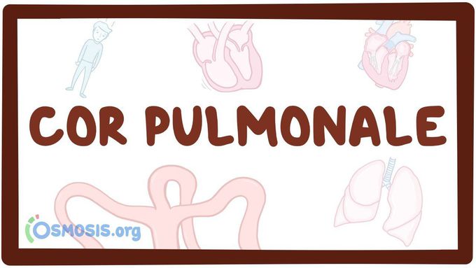 Cor pulmonale - causes, symptoms, diagnosis, treatment, pathology