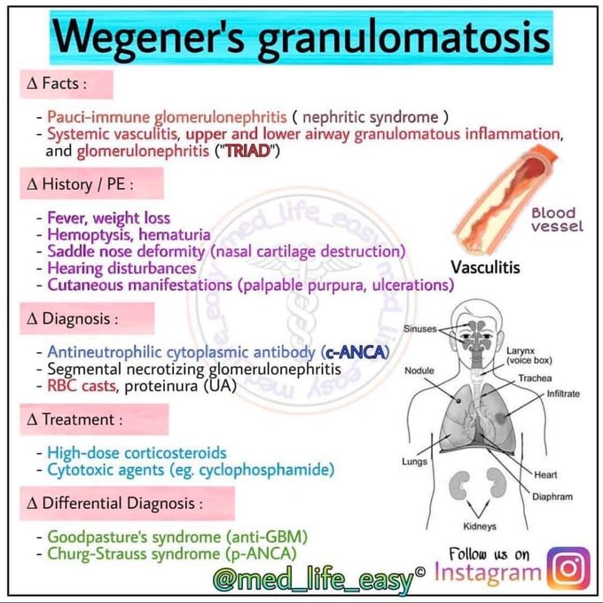 Wegener granulomatosis