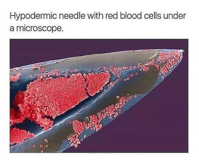 Hypodermic needle with red blood cells (RBC) under a microscope
