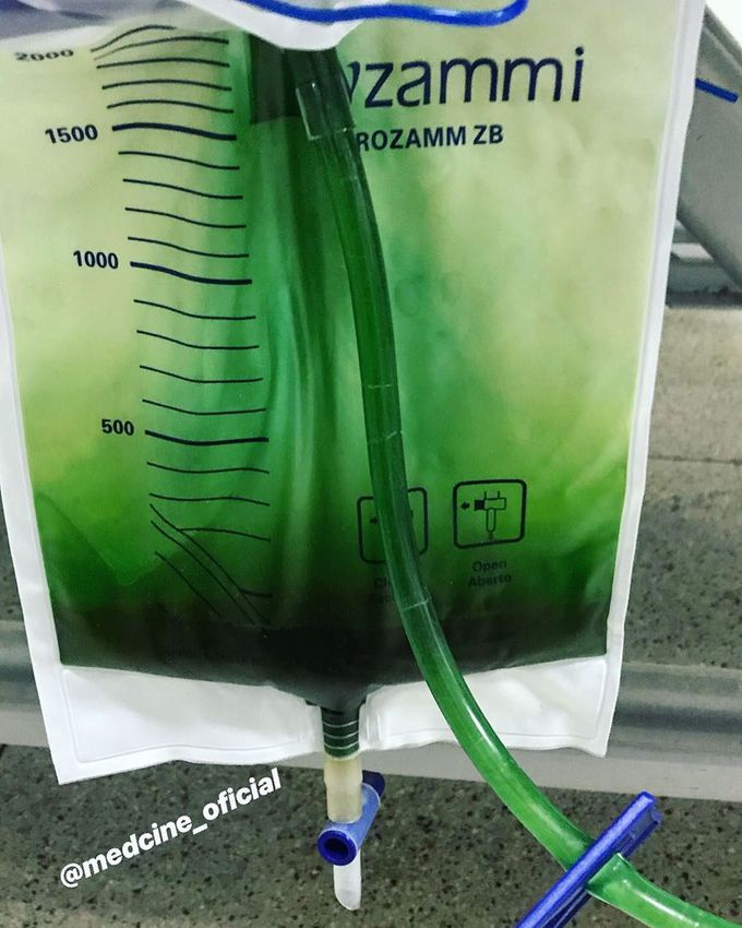 Green Urine