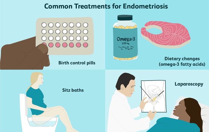Treatment of Endometriosis