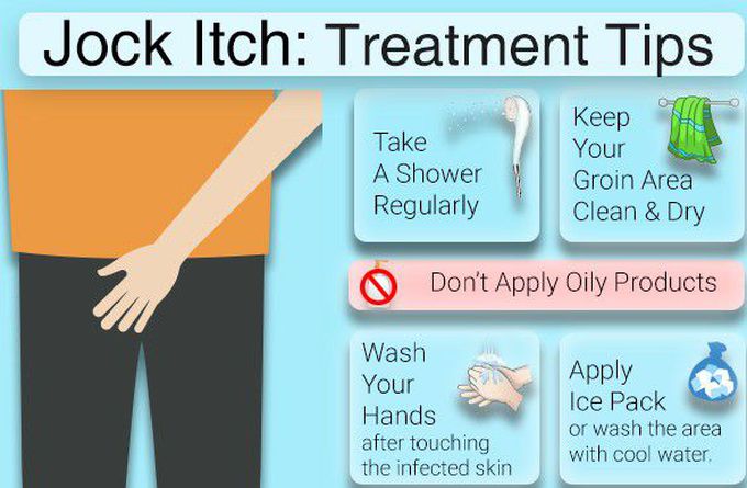 Treatment for jock itch
