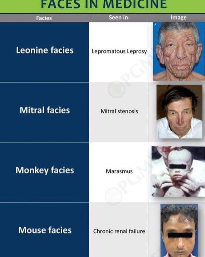 Faces