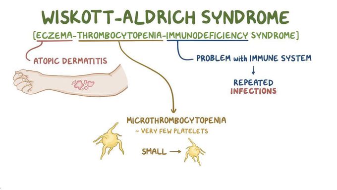 Wiskott-Aldrich Syndrome