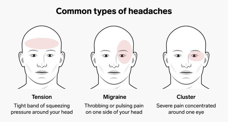 Types of Headache - MEDizzy