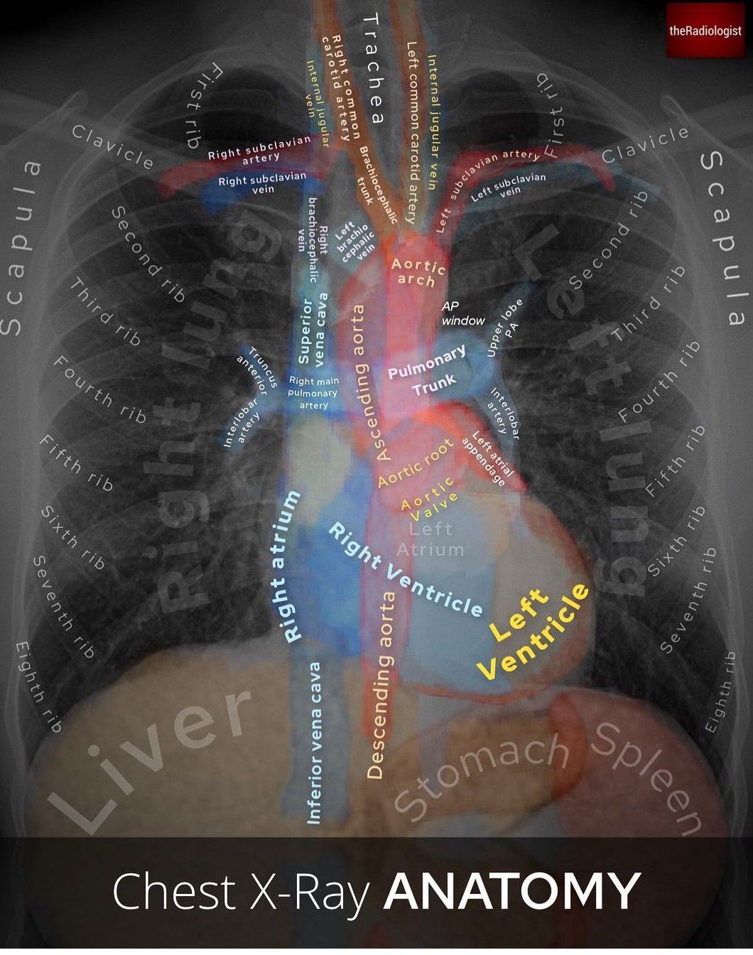 Chest X Ray Anatomy Medizzy