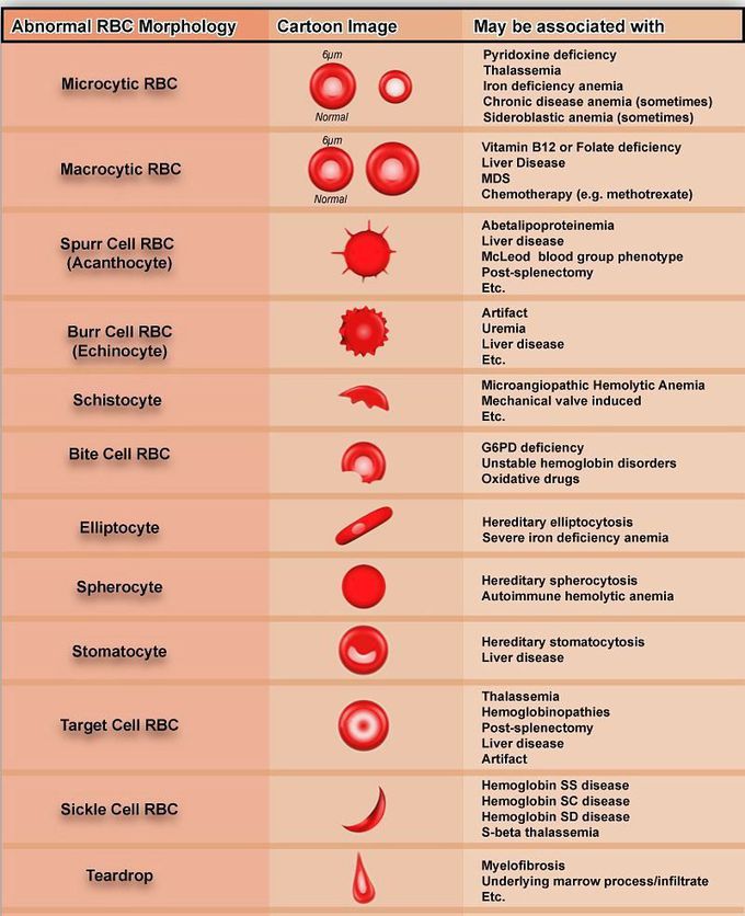 Some abnormal RBC morphology and their associated conditions