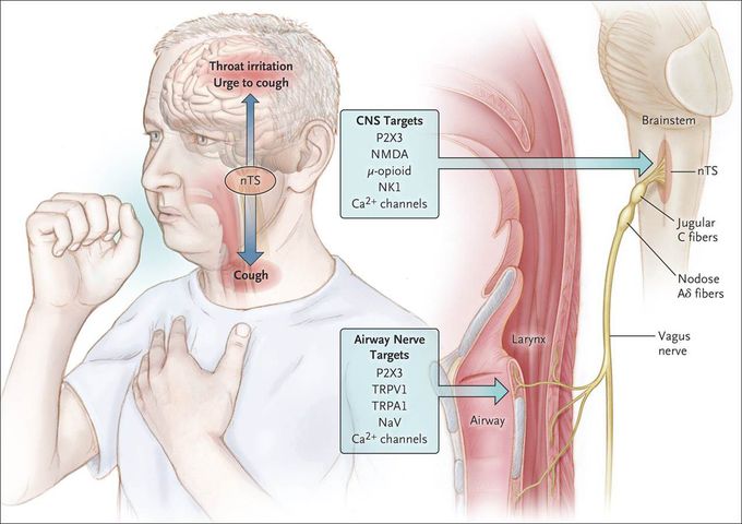 Chronic cough.