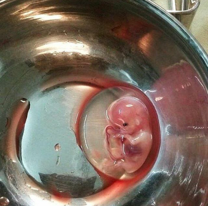 Embryo