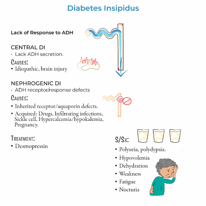 Diabetes Insipidus