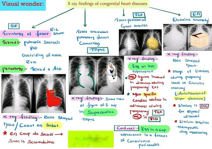 Congenital heart disease