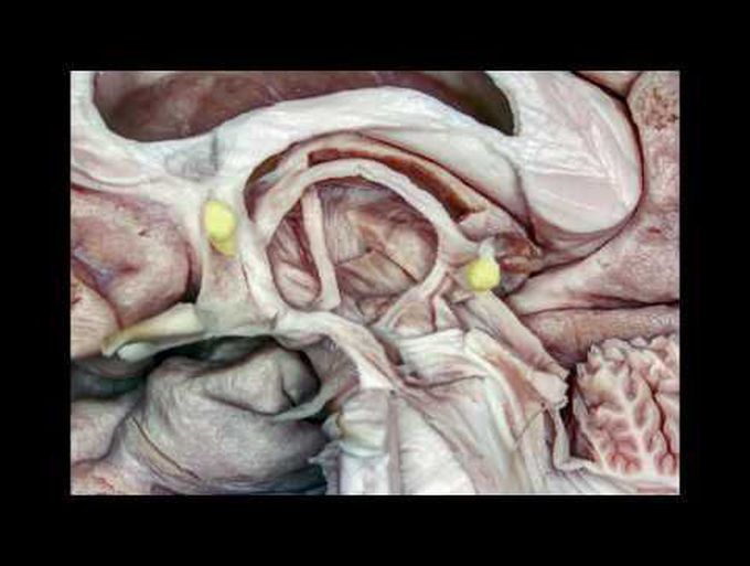 Fiber Pathways of the Cerebrum