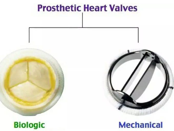 Prosthetic Heart Valves