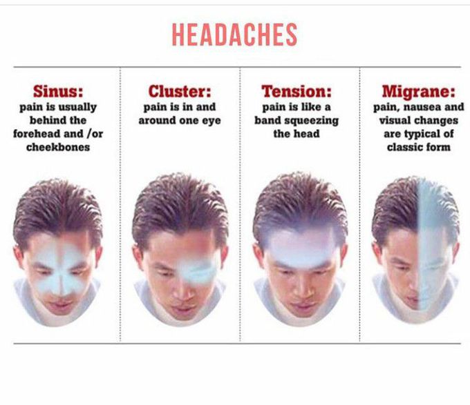 Types of headache