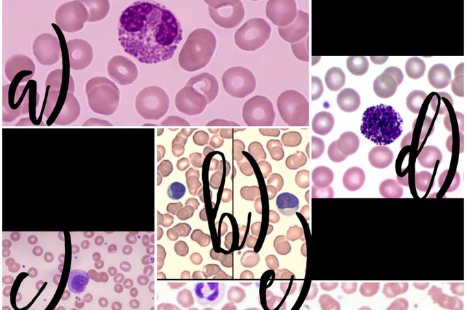 Leukocytes to identify in peripheral blood smear(DLC)