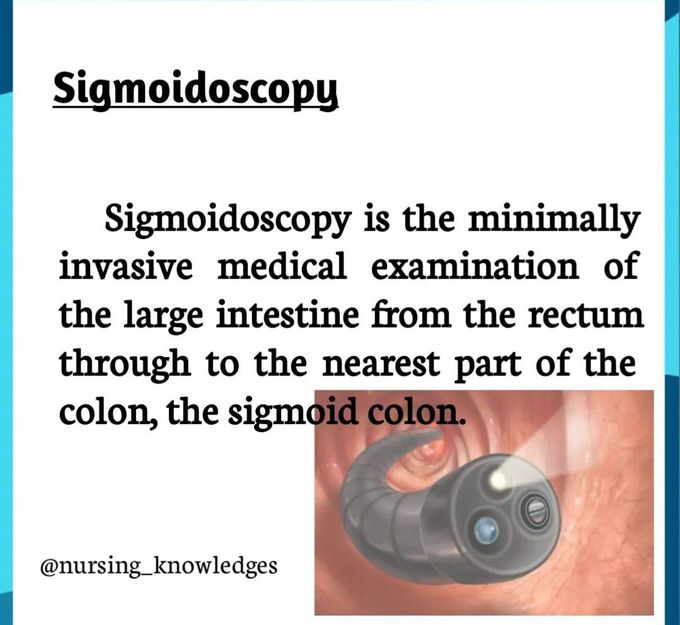 Sigmoidoscopy