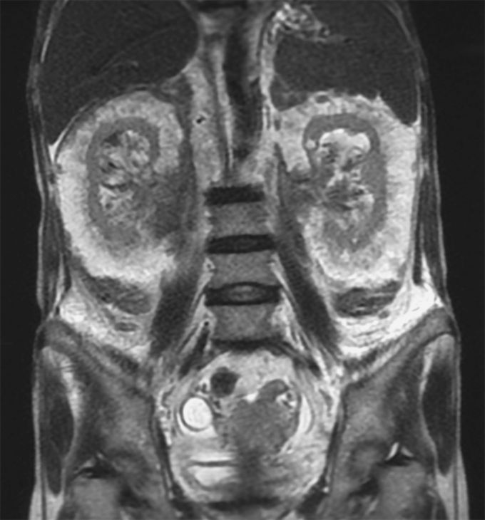 What is your diagnosis??