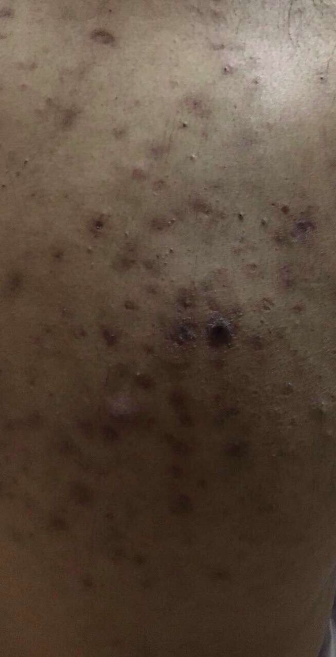 Abnormal skin