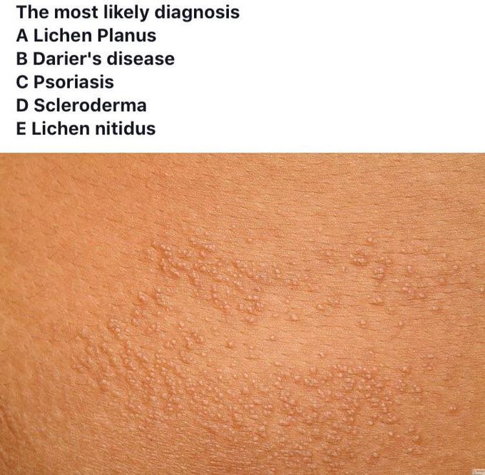Diagnose