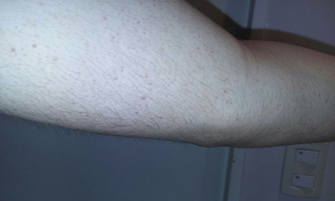 Diagnosis?