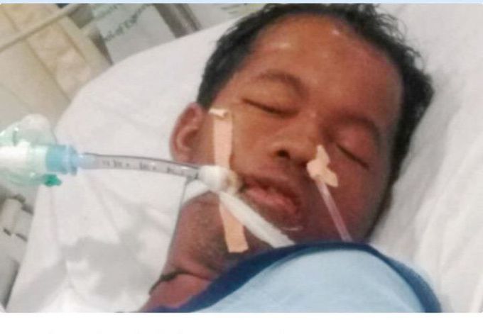 A medical student suffering from HEMOPHAGOCYTIC LYMPHOHISTIOCYTOSIS