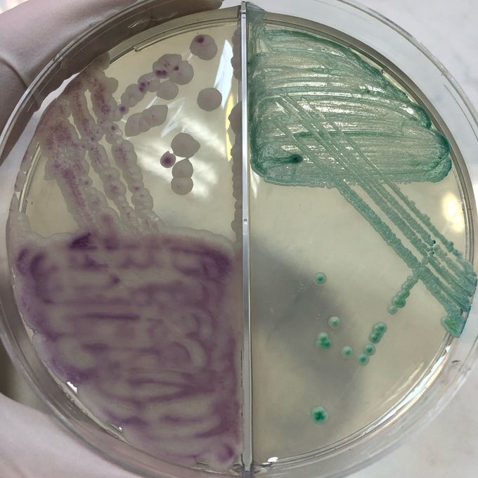 İdentification of Candida species on Chromatic ™ Candida agar