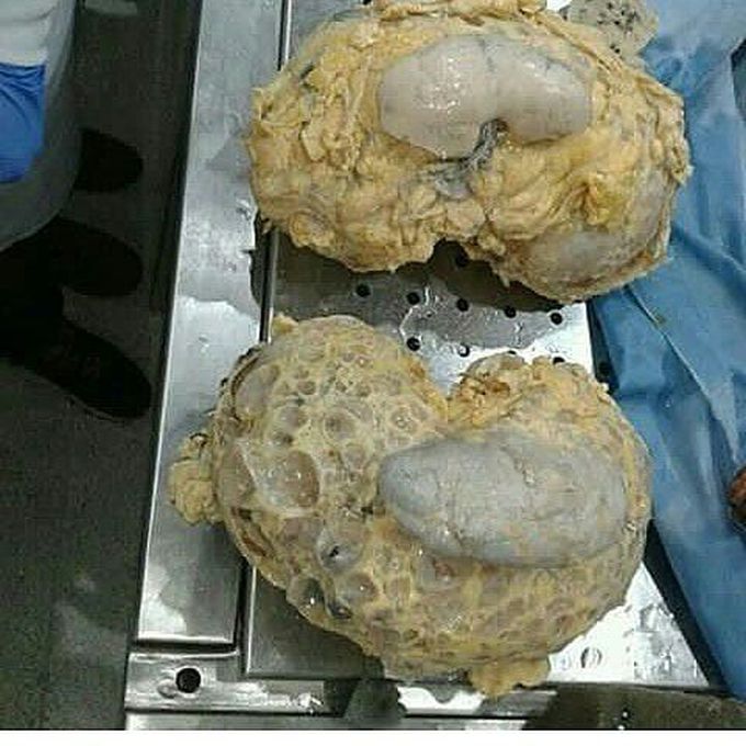 DIAGNOSIS?