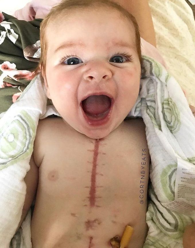Hit like for this little Hero ❤👼