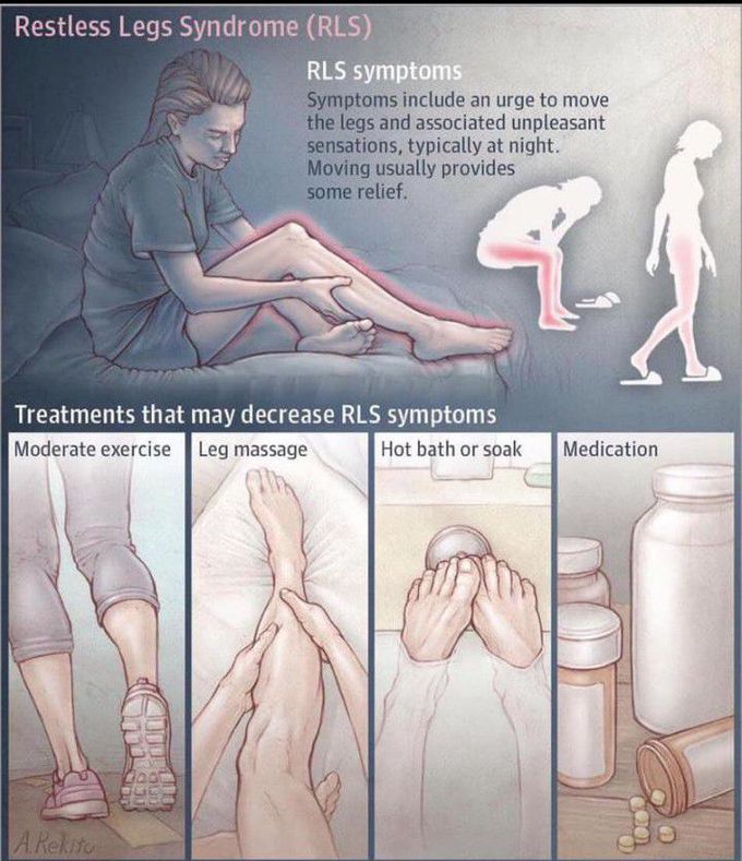 Restless leg syndrome