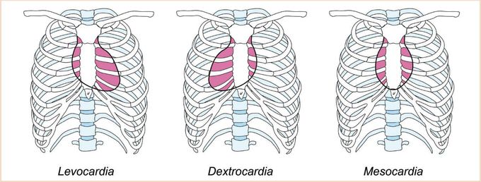 Heart positions
