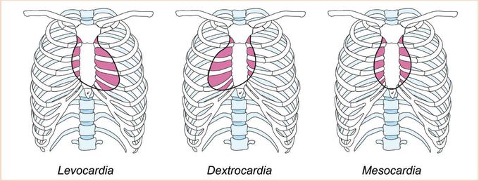 Heart positions