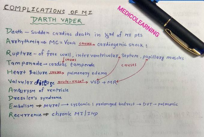 Complications of MI