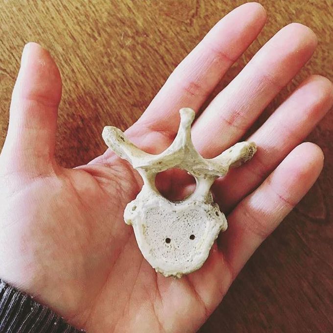 To Which Part Of The Spine This Vertebrae Belong To Medizzy 