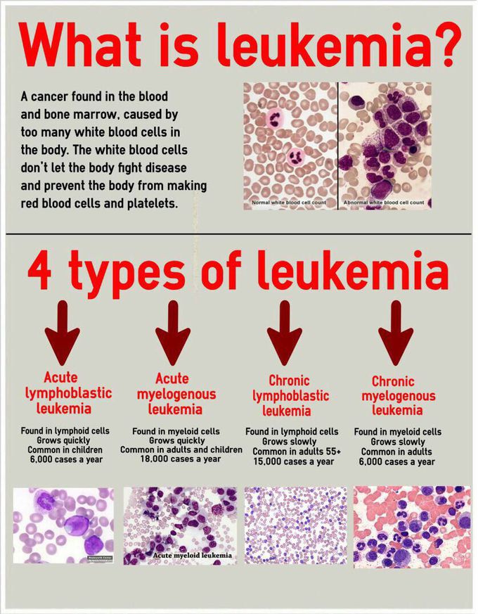 Leukemia