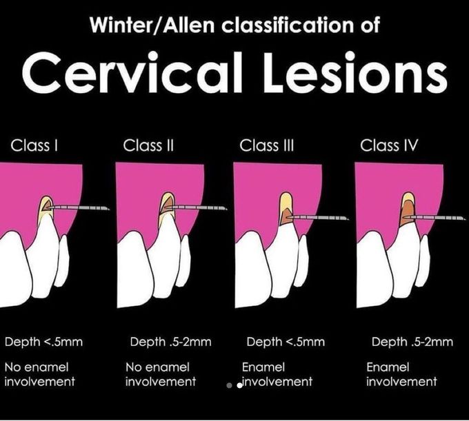 Cervical Lesions-Classification