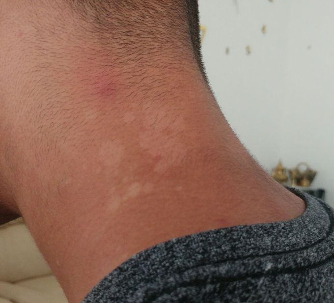 Diagnosis?