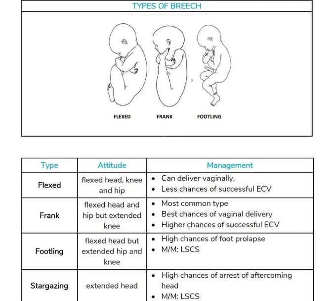 Types of Breech