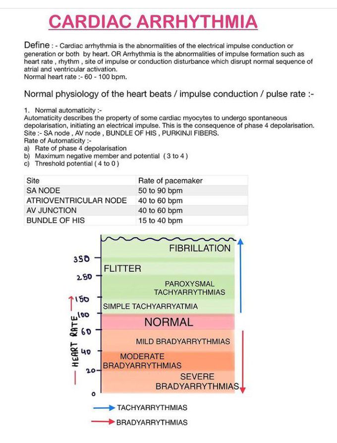 Cardiac Arrhythmia