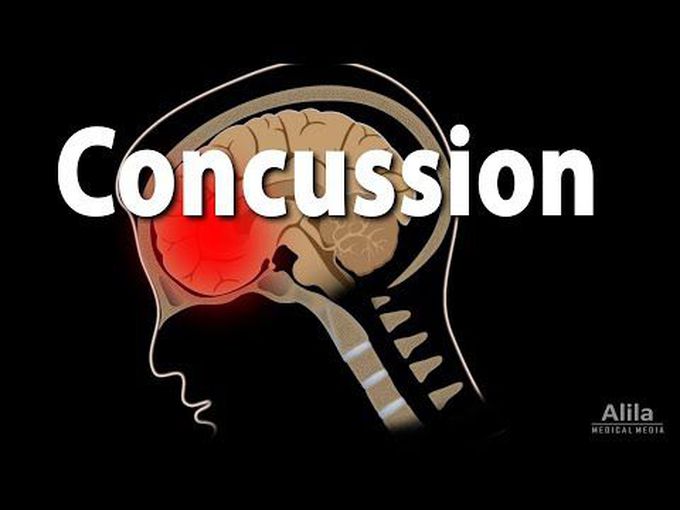Concussion: Overview