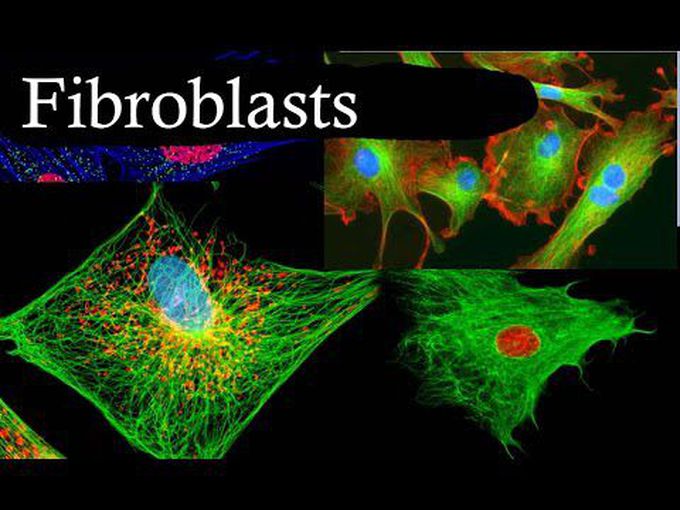 Fibroblasts-Connective Tissue
