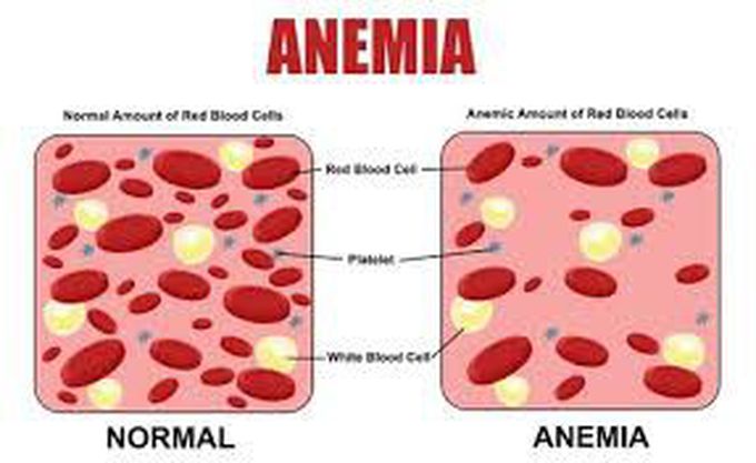 RBC quantity due to anaemia