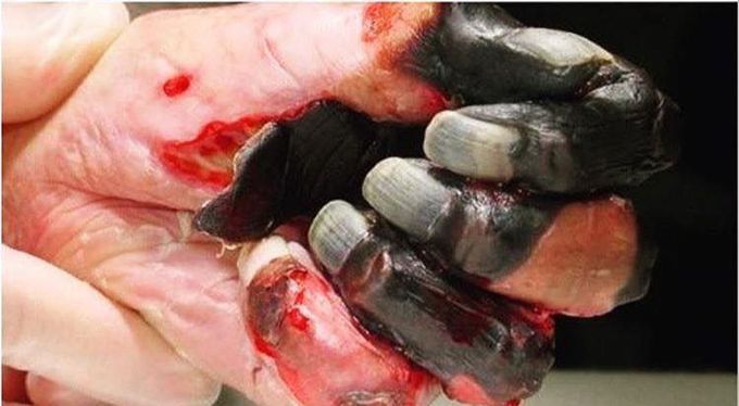 Diagnosis 🙄??