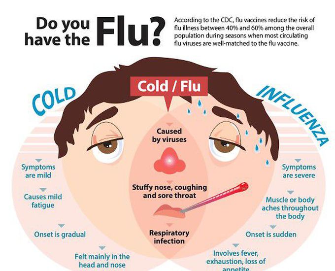 Symptoms of flu
