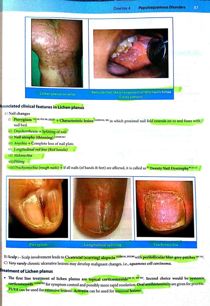 # Skin  # Lichen planus