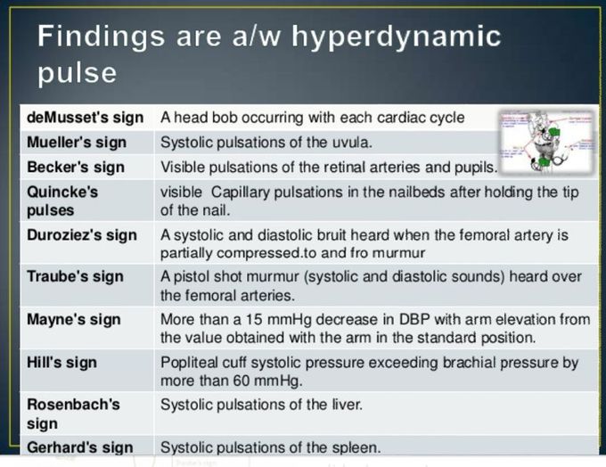 Aortic regurgitation signs