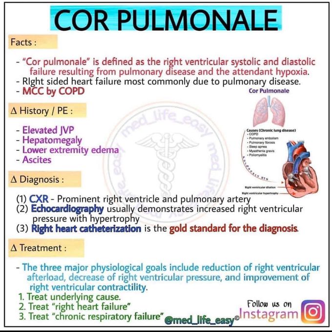 Core pulmonale