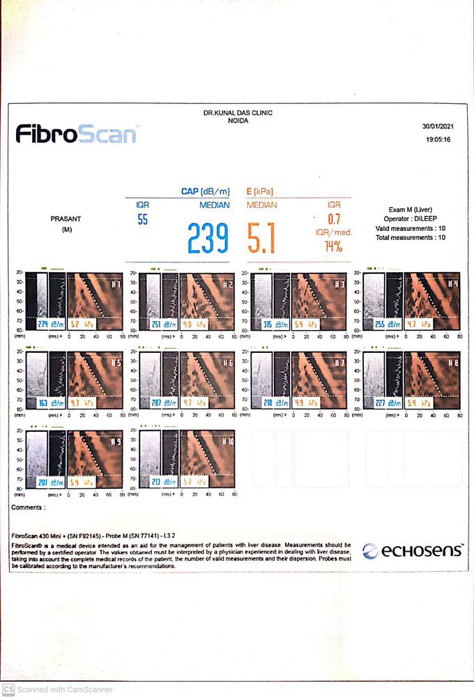 Fibroscan