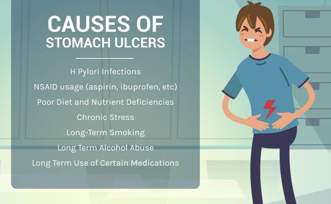 Causes of Peptic Ulcer