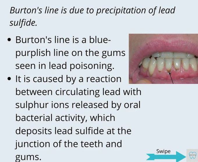 Burton's Line